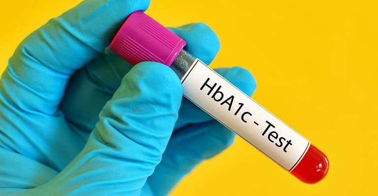 What Is an HbA1c Test, and What Is a Safe Score?